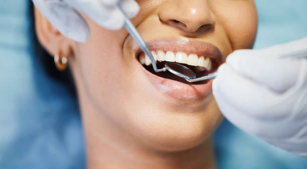 Best Periodontal (Gum) Disease Treatment  in Dunsmuir, CA